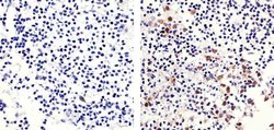 Invitrogen Phospho-Rb (Ser780) Recombinant Superclonal Antibody (13HCLC)