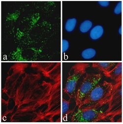 Phospho-Tau (Ser396) Recombinant Polyclonal Antibody (5HCLC), Invitrogen&trade;