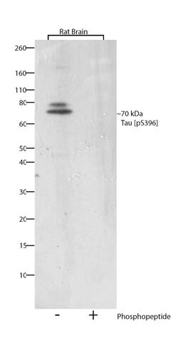 Phospho-Tau (Ser396) Recombinant Polyclonal Antibody (5HCLC), Invitrogen&trade;