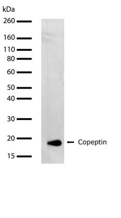 Invitrogen Copeptin Recombinant Superclonal Antibody (20HCLC) 100 &mu;g | Buy Online | Invitrogen&trade; | Fisher Scientific