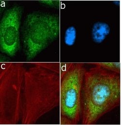 Invitrogen TIMP4 Recombinant Superclonal Antibody (13HCLC) 100 &mu;g; Unconjugated:Antibodies,