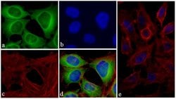 Invitrogen TIMP4 Recombinant Superclonal Antibody (13HCLC) 100 &mu;g; Unconjugated:Antibodies,