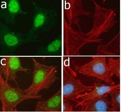 Invitrogen Phospho-TSC2 (Ser939) Recombinant Superclonal Antibody (23HCLC) 100 &mu;g | Buy Online | Invitrogen&trade; | Fisher Scientific
