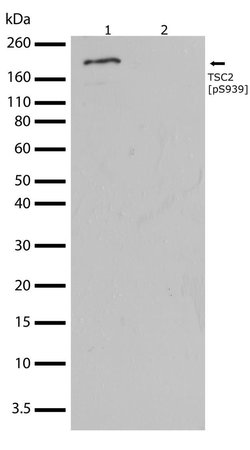 Invitrogen Phospho-TSC2 (Ser939) Recombinant Superclonal Antibody (23HCLC) 100 &mu;g | Buy Online | Invitrogen&trade; | Fisher Scientific