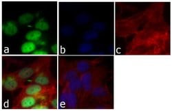 Invitrogen Cyclin D1 Recombinant Superclonal Antibody (17HCLC) 100 &mu;g;
