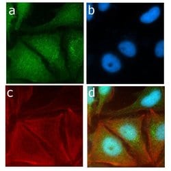 Invitrogen SRC Recombinant Superclonal Antibody (14HCLC) 100 &mu;g; Unconjugated:Antibodies,