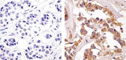 Invitrogen ErbB2 (HER-2) Recombinant Superclonal Antibody (7HCLC) 100 &mu;g;