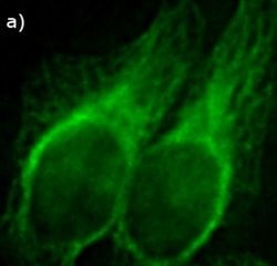 Invitrogen AFP Recombinant Superclonal Antibody (9HCLC) 100 &mu;g; Unconjugated:Antibodies,