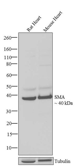 Invitrogen Alpha-Smooth Muscle Actin Recombinant Superclonal Antibody (17HCLC)