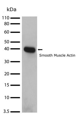 Invitrogen Alpha-Smooth Muscle Actin Recombinant Superclonal Antibody (17HCLC)