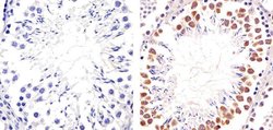 Invitrogen PIM1 Recombinant Superclonal Antibody (19HCLC) 100 &mu;g; Unconjugated:Antibodies,