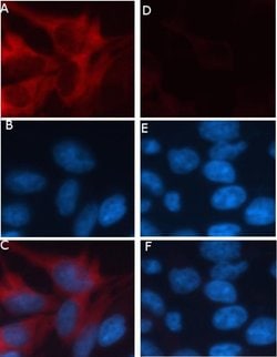 Invitrogen RFP Recombinant Superclonal Antibody 100 &mu;g; Unconjugated:Antibodies,