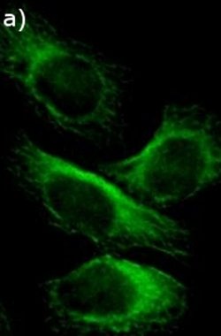 Invitrogen SQSTM1 Recombinant Superclonal Antibody (11HCLC) 100 &mu;g;