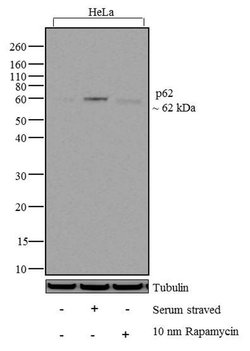Invitrogen SQSTM1 Recombinant Superclonal Antibody (11HCLC) 100 &mu;g;