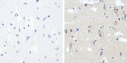 Invitrogen Phospho-Tau (Thr181) Recombinant Superclonal Antibody (5HCLC)