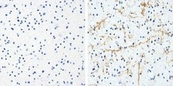 Invitrogen Phospho-Tau (Thr181) Recombinant Superclonal Antibody (5HCLC)