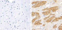 Invitrogen Phospho-Tau (Thr181) Recombinant Superclonal Antibody (5HCLC)