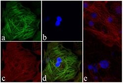 Invitrogen Troponin I Recombinant Superclonal Antibody (1HCLC) 100 &mu;g;