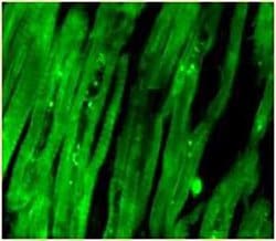 Invitrogen Troponin I Recombinant Superclonal Antibody (1HCLC) 100 &mu;g;