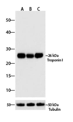 Invitrogen Troponin I Recombinant Superclonal Antibody (1HCLC) 100 &mu;g;