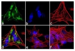 Invitrogen&trade;&nbsp;Huntingtin Recombinant Superclonal&trade; Antibody (3HCLC)