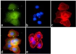 SMAD4 Recombinant Polyclonal Antibody (10HCLC), Invitrogen 100 &mu;g; Unconjugated:Antibodies,