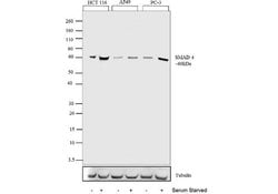 SMAD4 Recombinant Polyclonal Antibody (10HCLC), Invitrogen 100 &mu;g; Unconjugated:Antibodies,