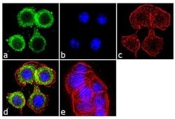 Invitrogen TGFBR2 Recombinant Superclonal Antibody (16HCLC) 100 &mu;g;