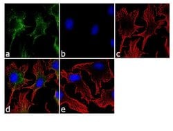 ATG12 Recombinant Polyclonal Antibody (20 HCLC), Invitrogen 100 &mu;g;