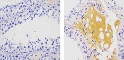 Invitrogen ATG16L1 Recombinant Superclonal Antibody (17HCLC) 100 &mu;g;