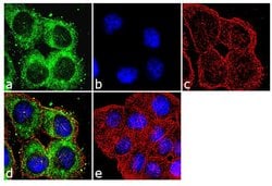 Invitrogen FZD4 Recombinant Superclonal Antibody (22HCLC) 100 &mu;g; Unconjugated:Antibodies,