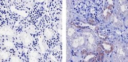 Invitrogen FZD4 Recombinant Superclonal Antibody (22HCLC) 100 &mu;g; Unconjugated:Antibodies,