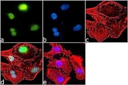 H2BK5ac Recombinant Superclonal Antibody (24HCLC):Antibodies, Recombinant