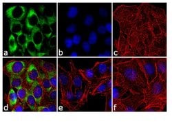 Invitrogen&trade;&nbsp;Phospho-S6 (Ser240, Ser244) Recombinant Superclonal&trade; Antibody (11 HCLC)