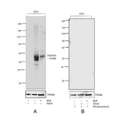 Invitrogen Phospho-FOXO4 (Thr28) Recombinant Superclonal Antibody (12HCLC)