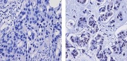 Invitrogen Phospho-FOXO4 (Thr28) Recombinant Superclonal Antibody (12HCLC)