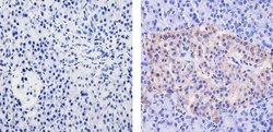 Invitrogen WNT2B Recombinant Superclonal Antibody (17HCLC) 100 &mu;g | Buy Online | Invitrogen&trade; | Fisher Scientific