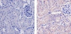 Invitrogen WNT2B Recombinant Superclonal Antibody (17HCLC) 100 &mu;g | Buy Online | Invitrogen&trade; | Fisher Scientific