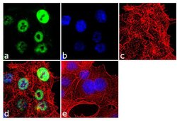 RNF20 Recombinant Polyclonal Antibody (10HCLC), Invitrogen 100 &mu;g; Unconjugated:Antibodies,
