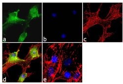 NOTCH2 Recombinant Polyclonal Antibody (18HCLC), Invitrogen 100 &mu;g;