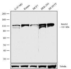 NOTCH2 Recombinant Polyclonal Antibody (18HCLC), Invitrogen 100 &mu;g;