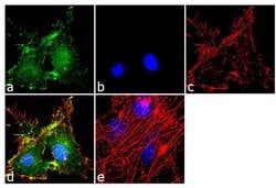 Invitrogen GLT-1 Recombinant Superclonal Antibody (9 HCLC) 100 &mu;g; Unconjugated:Antibodies,