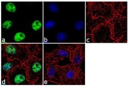 Invitrogen TDP-43 Recombinant Superclonal Antibody (1HCLC) 100 &mu;g; Unconjugated:Antibodies,