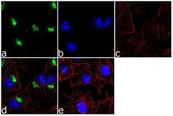 Invitrogen alpha-1 Antitrypsin Recombinant Superclonal Antibody 100 &mu;g;