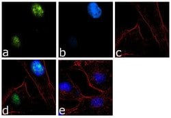 Invitrogen&trade;&nbsp;TERT Recombinant Superclonal&trade; Antibody (19HCLC)