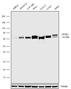 Invitrogen SSTR2 Recombinant Superclonal Antibody (11HCLC) 100 &mu;g | Buy Online | Invitrogen&trade; | Fisher Scientific
