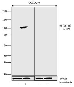 Invitrogen Phospho-Rb (Ser788) Recombinant Superclonal Antibody (6HCLC)