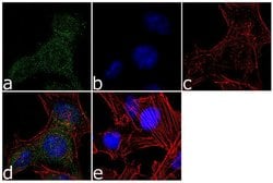 Invitrogen LATS1 Recombinant Superclonal Antibody (2HCLC) 100 &mu;g; Unconjugated:Antibodies,