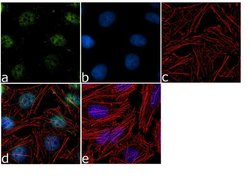 Invitrogen RAD1 Recombinant Superclonal Antibody (8HCLC) 100 &mu;g; Unconjugated:Antibodies,