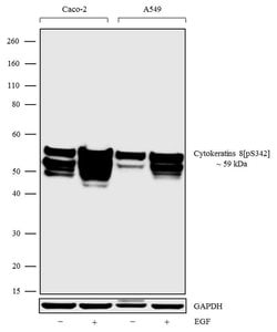 Invitrogen Phospho-Cytokeratin 8 (Ser432) Recombinant Superclonal Antibody (21HCLC) 100 &mu;g | Buy Online | Invitrogen&trade; | Fisher Scientific